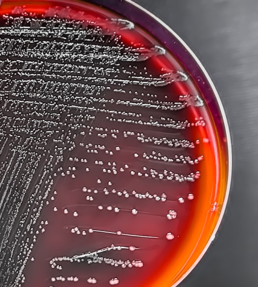 water treatment chemistry